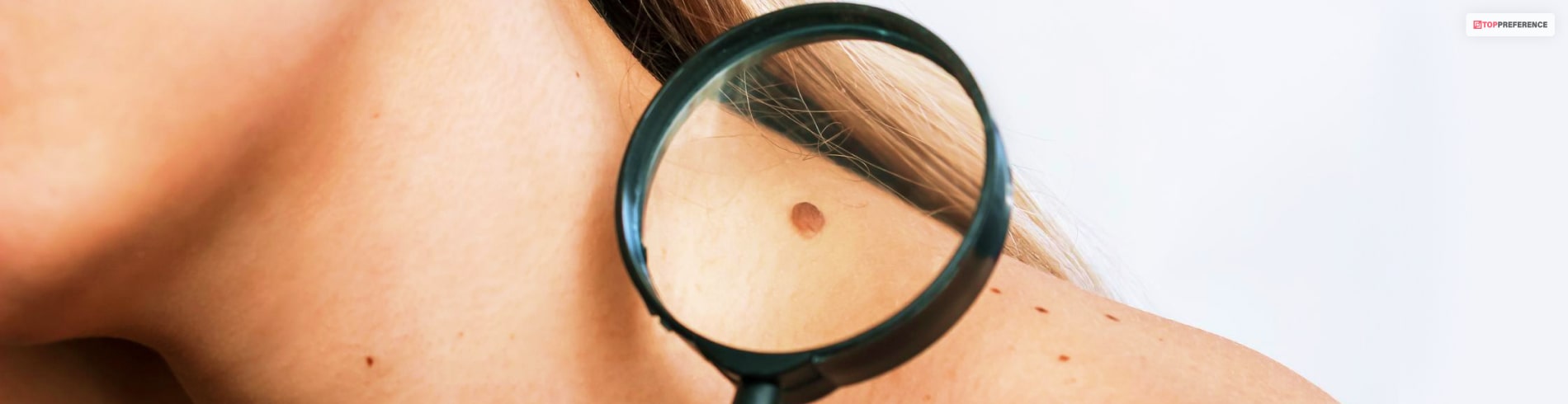 how to remove skin tags in one night